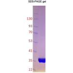 Recombinant Human PKMYT1, catalytic domain – phosphorylated